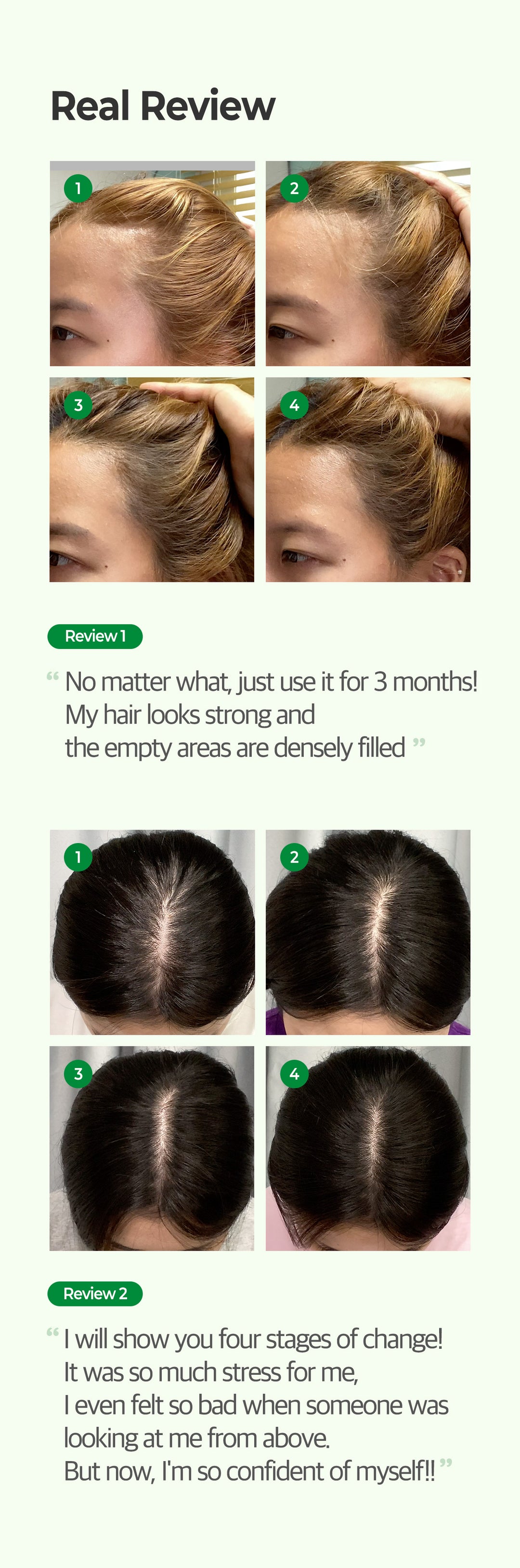 Some By Mi Cica Peptide Anti Hair Loss Derma Scalp Shampoo 285ml